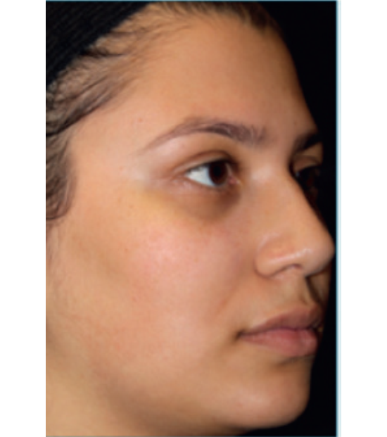 C+B Face Treatments 1