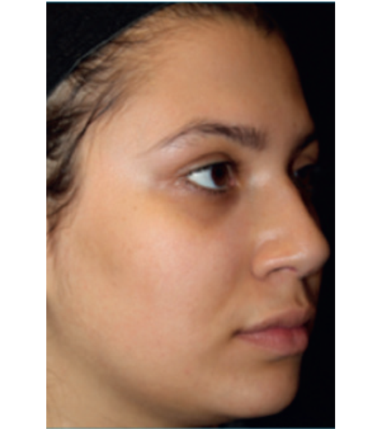 C+B Face Treatments 1