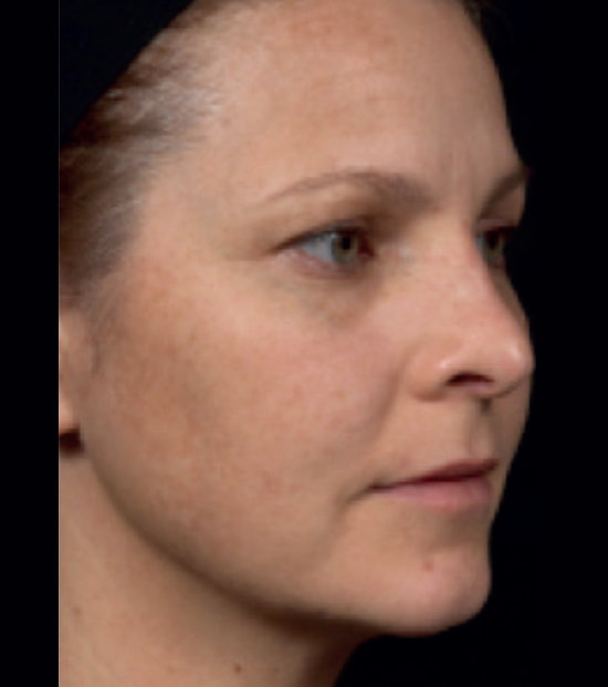C+B Face Treatments 2